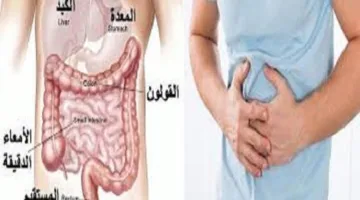 د. محمد سيرة: متلازمة القولون المتهيج حالة مزمنة تستدعي علاجاً طويلاً.