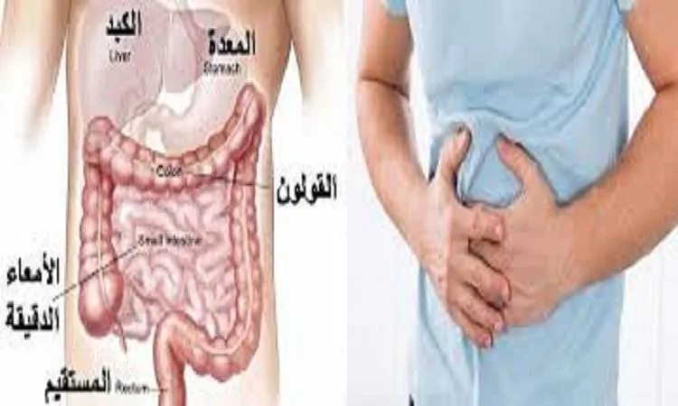 د. محمد سيرة: متلازمة القولون المتهيج حالة مزمنة تستدعي علاجاً طويلاً. د. محمد سيرة: متلازمة القولون المتهيج حالة مزمنة تستدعي علاجاً طويلاً.