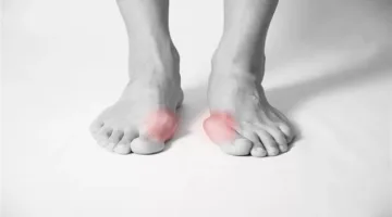 علامات في القدمين تنذر بخلل في وظائف الكبد وإجهاد القلب: كن حذرًا من 5 مؤشرات.