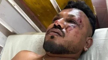 مستجدات حول الناجي الوحيد من الطائرة الهندية المنكوبة.. موقع مقعده يجنبه الموت