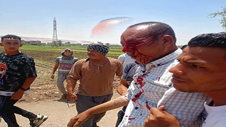 نقدم تقريراً طبياً عن مدير حماية الأراضي الذي تعرض للاعتداء خلال الحملة في سوهاج. نقدم تقريراً طبياً عن مدير حماية الأراضي الذي تعرض للاعتداء خلال الحملة في سوهاج.